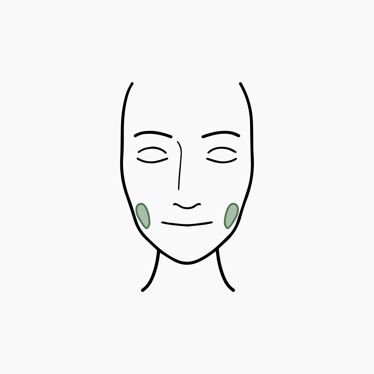 files/FillerMap-jawline.jpg