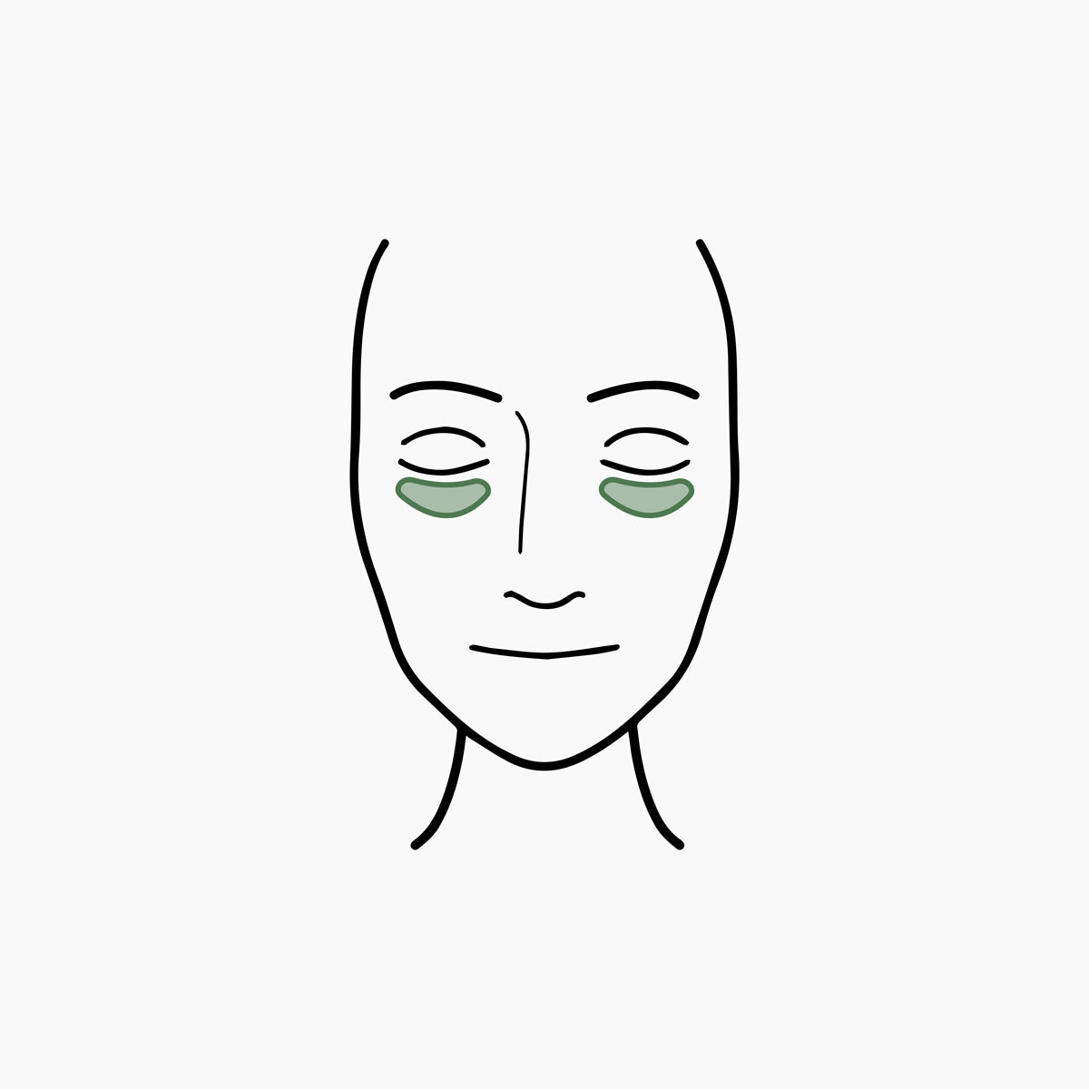 files/FillerMap-undereye.jpg